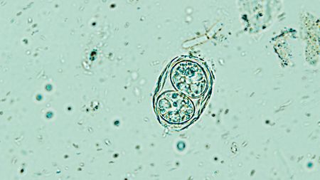 Toxoplasma - parazit, který mění naše chování, vzhled i sexuální přitažlivost