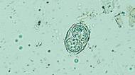 Toxoplasma - parazit, který mění naše chování, vzhled i sexuální přitažlivost