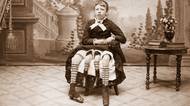 Čtyři nohy a dva funkční pohlavní orgány: Neuvěřitelný život a smutný konec Myrtle Corbin